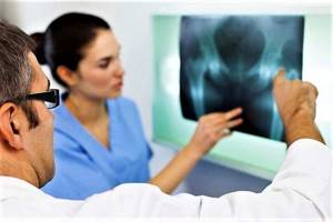 Остеопороз коленного сустава: симптомы и лечение