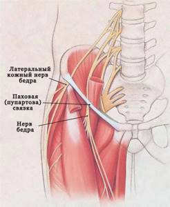 Защемление нерва в тазобедренном суставе: лечение ущемления, симптомы