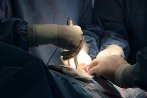 Операция по замене тазобедренного сустава: подробная инструкция