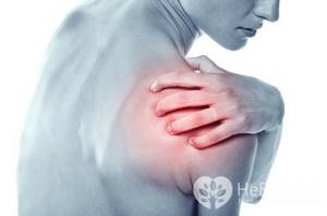 Артроз плечевого сустава: симптомы и лечение, причины и диагностика