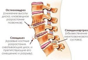 Болит шея сзади: причины появления боли, лечение