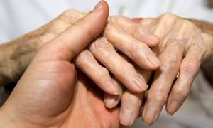 Полиостеоартроз мелких суставов кистей рук и стоп