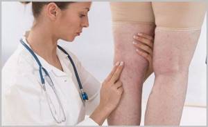 Боль в ноге от бедра до колена: причины, лечение, почему болит нога