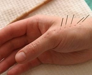 Артрит пальцев рук: диагностика, лечение, профилактика и фото болезни