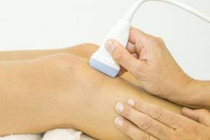 Гонартроз коленного сустава 3 степени: лечение, причины, симптомы