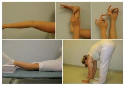 Гипермобильность суставов: что это и как лечить детей и взрослых