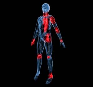 Реактивный полиартрит суставов: симптомы и лечение
