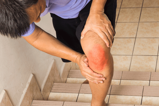 Ревматизм ног: признаки и лечение, профилактика, питание