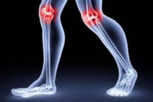 Лигаментит коленного сустава: симптомы и лечение связок