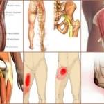 Тендиноз тазобедренного сустава: симптомы и лечение